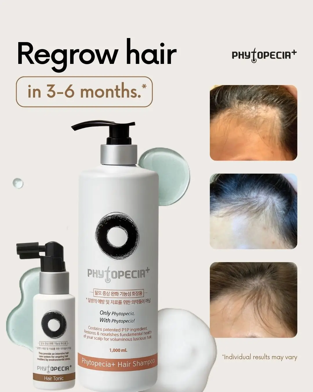Ksisters Carousel hair care ad: Social-proof ad for Korea’s number-one hair-loss shampoo, 87,000 bottles sold, frame 2 of 3