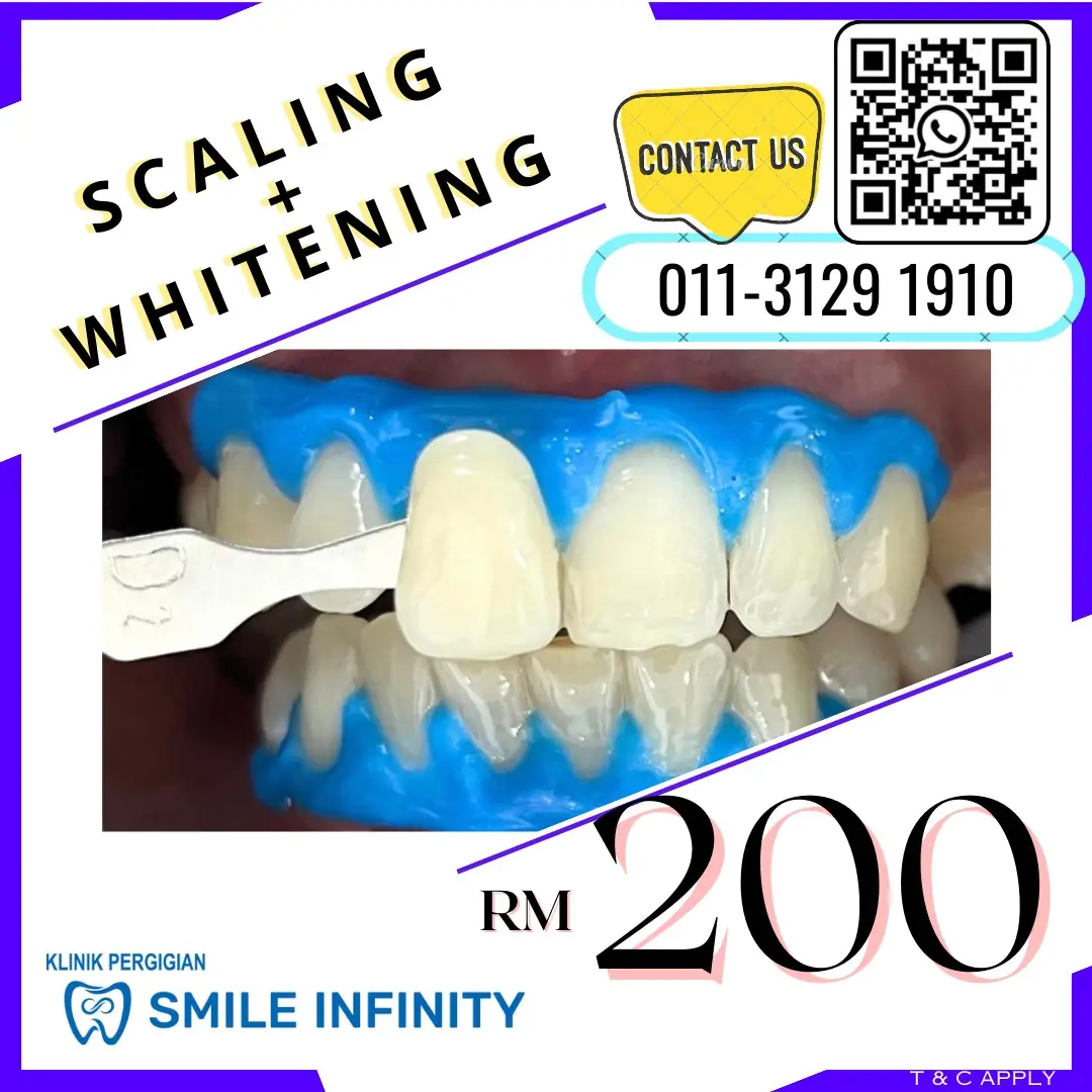 Klinik Pergigian Smile Infinity Puncak Jalil Dynamic dental clinics ad: Showcase ad for scaling + whitening