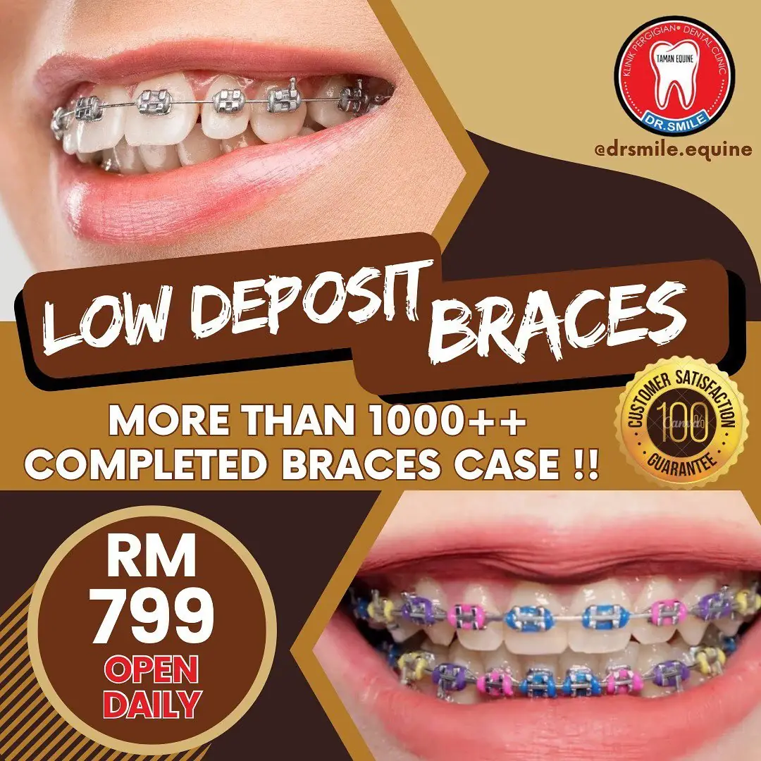 Klinik Pergigian Dr Smile Taman Equine Static dental clinics ad: Showcase ad for low deposit braces