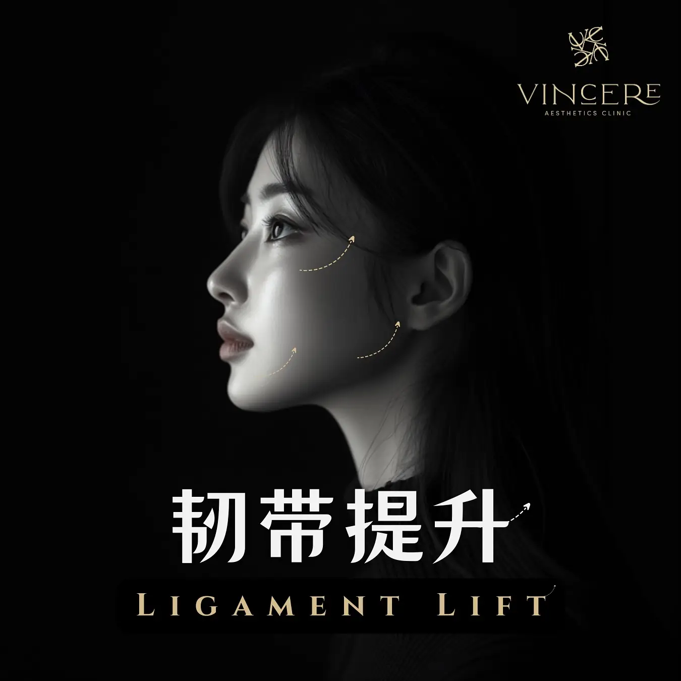 Vincere Aesthetics Clinic Static aesthetic clinics ad: Showcase ad for 韧带提升 ligament lift