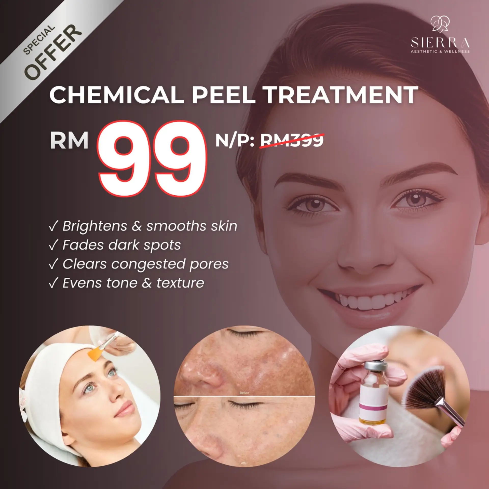Sierra Kota Kinabalu Static skincare ad: Discount ad: clinic chemical peel for RM99, normally RM399